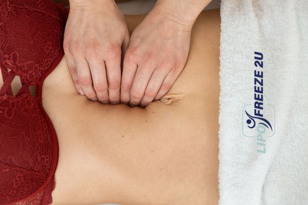 diastasis recti treatment Chigwell