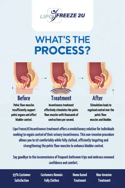 Diagram of how incontinence treatment Chigwell works.