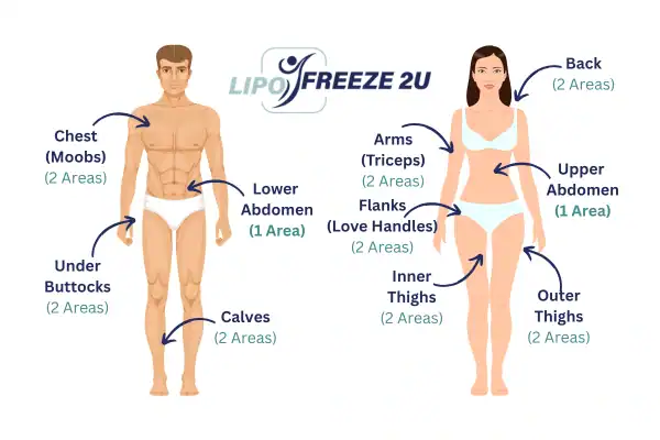 Areas you can have fat freezing treatment Chigwell