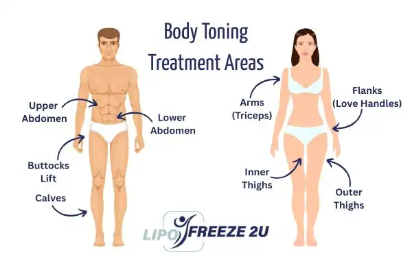 Graphic showing where you can have Body toning Treatment Chigwell on your body