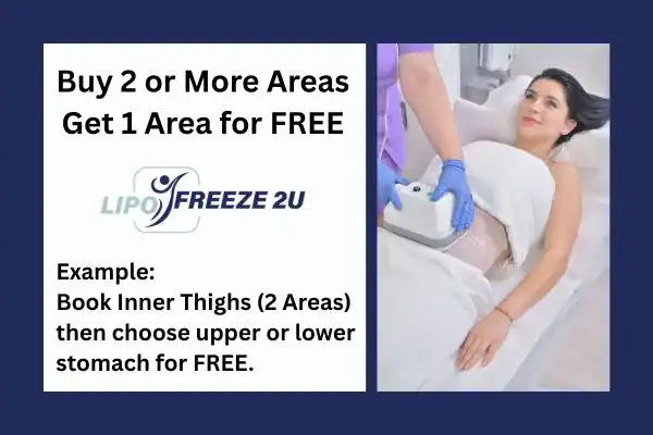fat freezing prices Chigwell