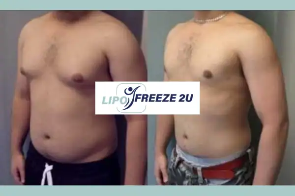 How Long Does It Take to See Results Chigwell?