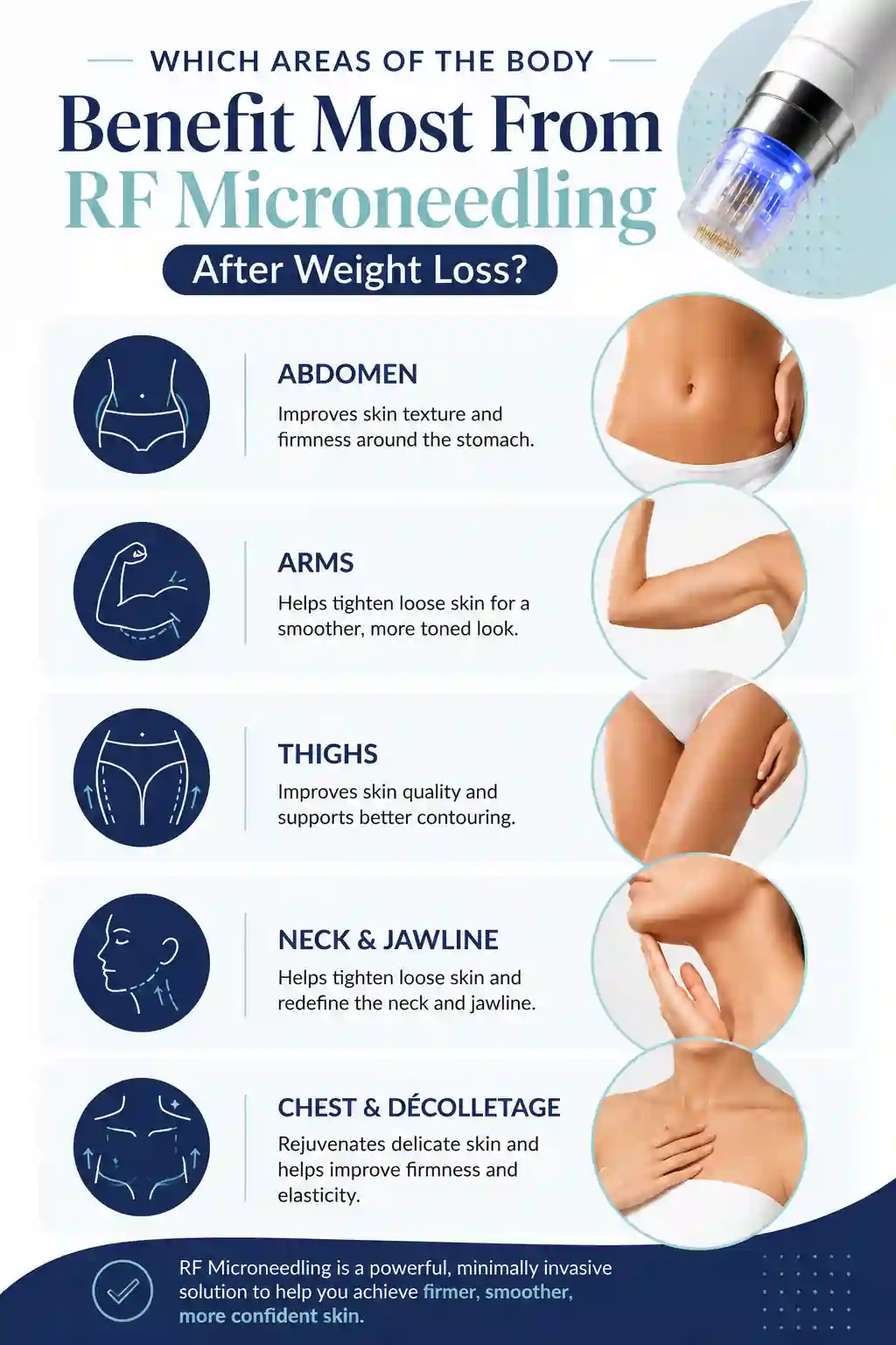 Which Areas of the Body Benefit Most From RF Microneedling After Weight Loss Chigwell